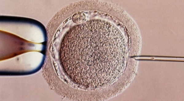 希臘32歲女子用實驗性人工受孕方法誕下u三人嬰兒v(互聯網)