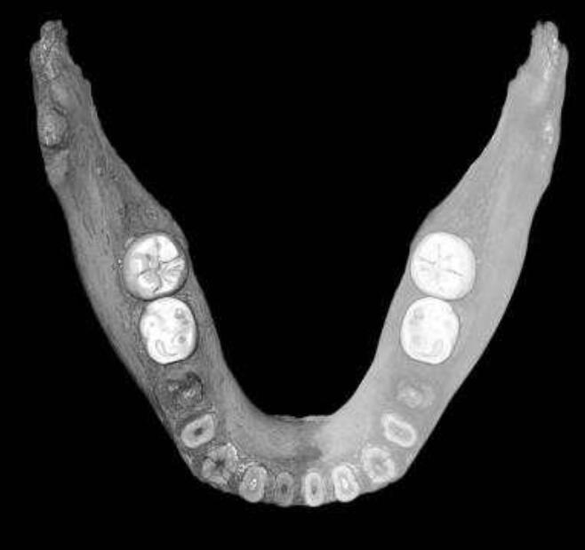 用數字化方法去除表面附着的碳酸鹽後虛擬重建的下頜骨圖片C讓-雅克P胡布林供圖