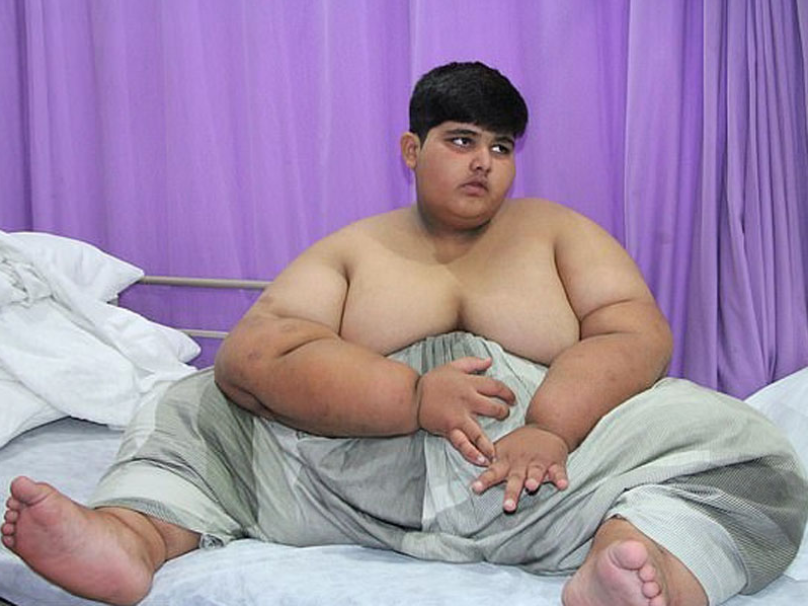 10歲的穆罕默德P阿布拉爾體重高達197公斤]網絡圖片^