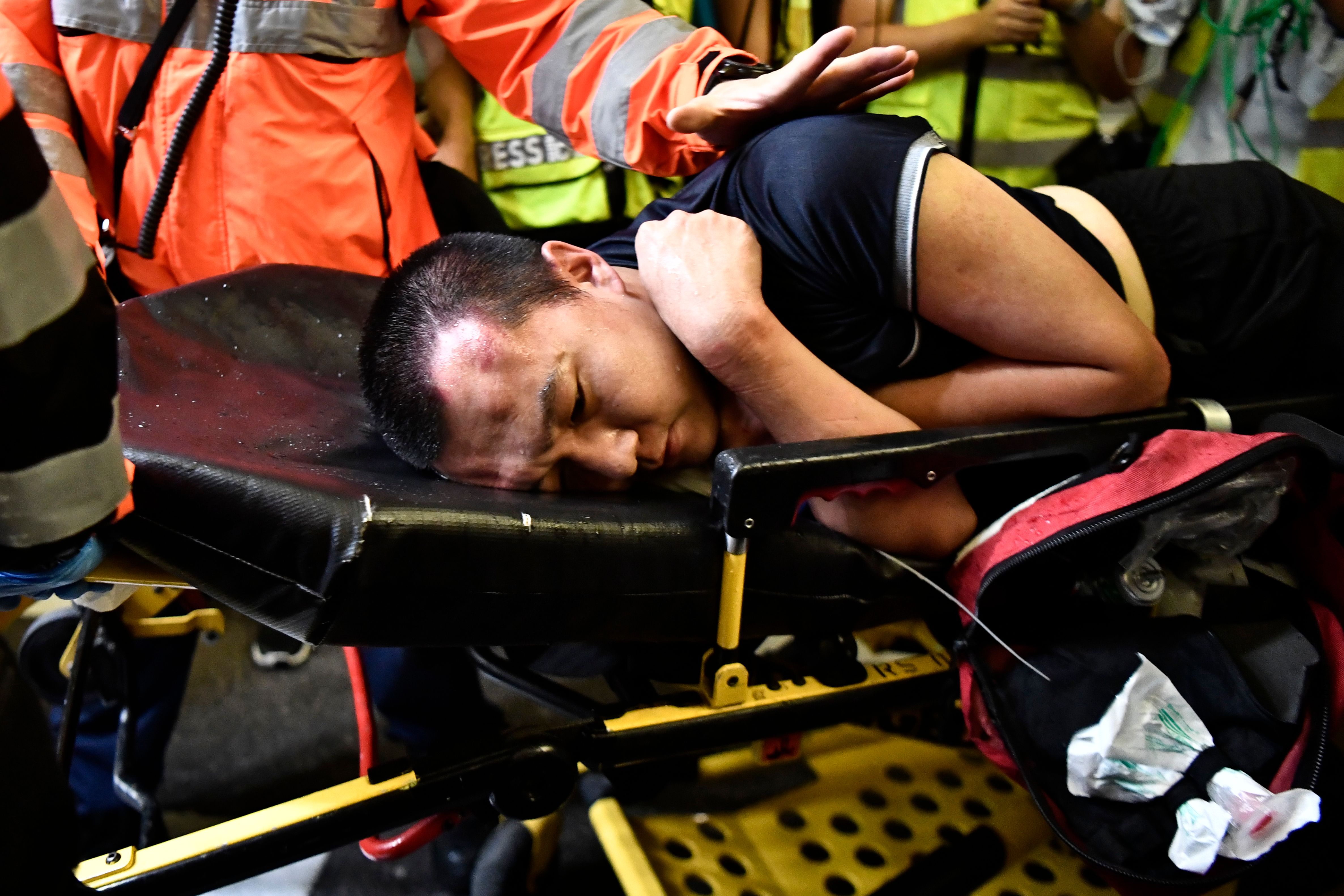 付國豪被送上救護車時額頭明顯受傷（圖源：法新社）