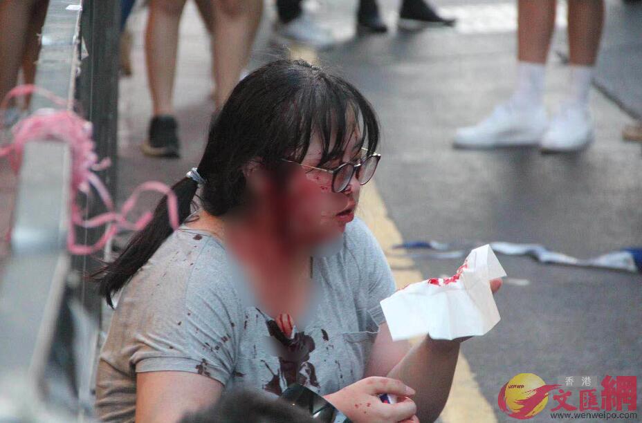一名女性市民被暴徒毆打至頭破血流(大公文匯全媒體記者攝)