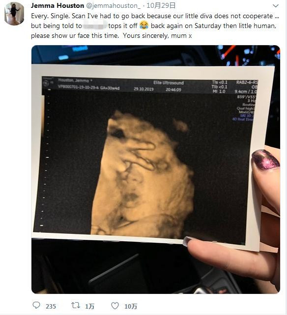 當地時間10月30日A英國一名准媽媽傑瑪發文並配圖稱A產檢照片顯示A自己尚未出世的女兒在肚內比出了一個uVv字的手勢C圖片來源G社交媒體截圖C