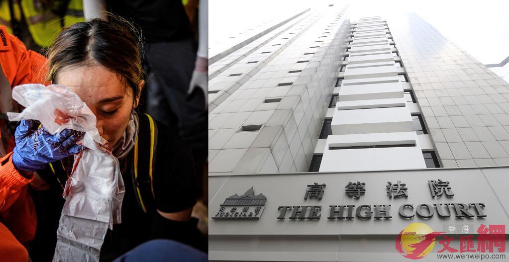 香港高院審理右眼受傷女子反對警方取得醫療報告覆核案C