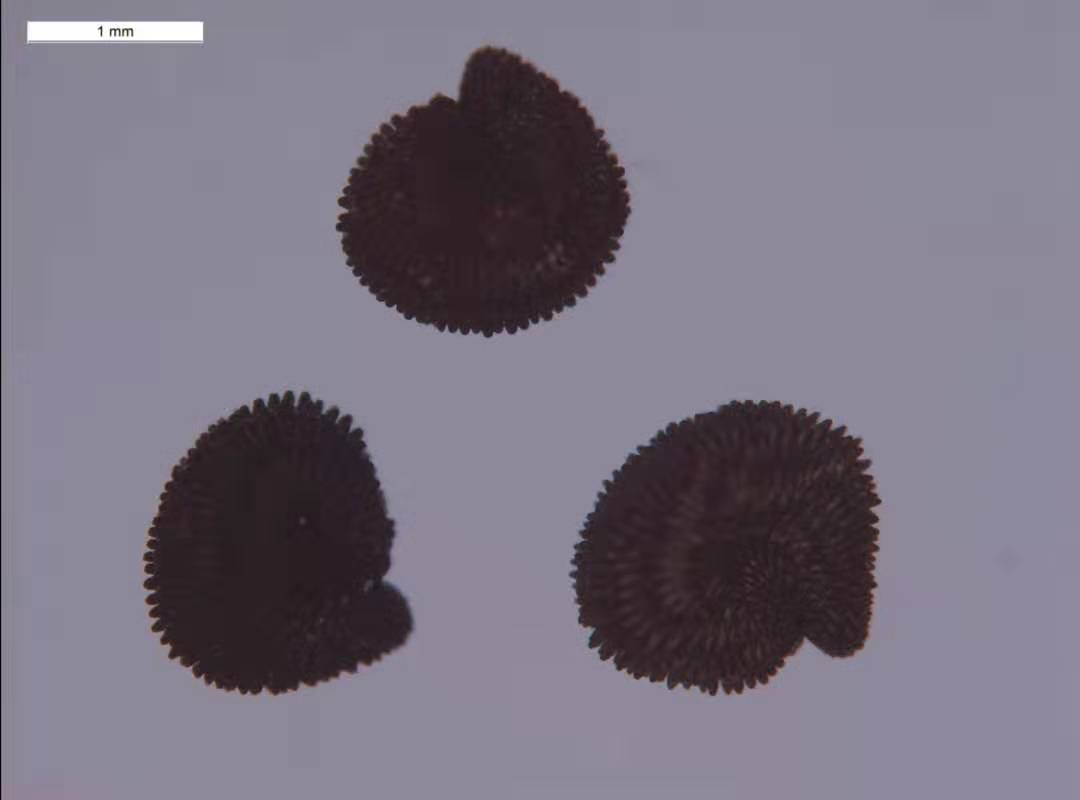 顯微鏡下拍攝的多毛石頭花]銀川海關供圖^