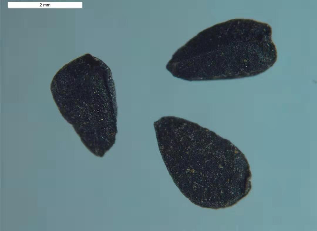 顯微鏡下拍攝的黑種草種子]銀川海關供圖^
