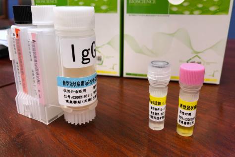 重慶公布試劑盒檢測結果AIgM靈敏度為93.7%A特異性為99.4%;IgG靈敏度為89.6%A特異性為99.2%(受訪者供圖)