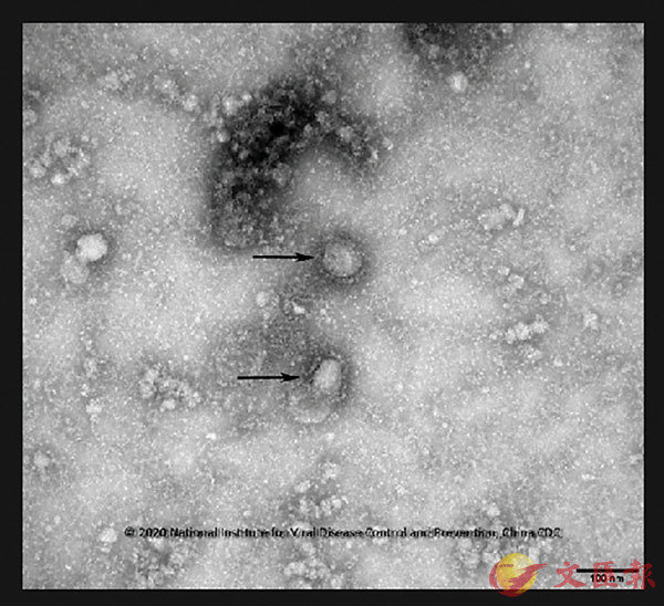 GISAID網站上載的一張由中國疾控中心提供的新型冠狀病毒在顯微鏡下的照片。
