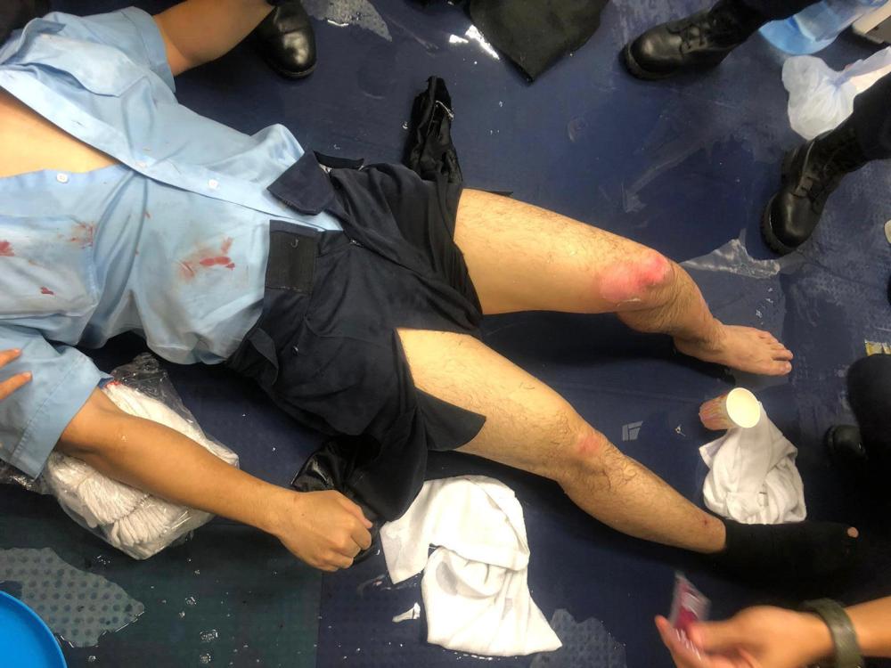 2019年8月11日A一名香港警察被暴徒投擲的汽油彈燒傷C(新華社發)