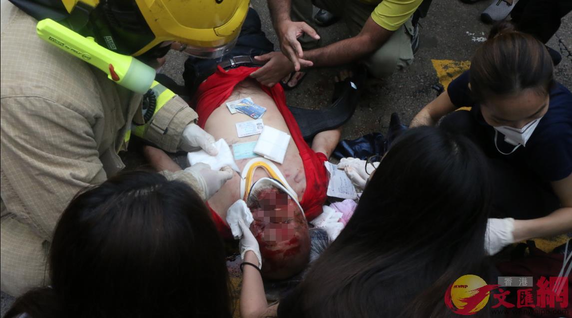 2019年10月6日A深水埗A的士司機鄭國泉被打至頭破血流]香港文匯報 記者 攝^